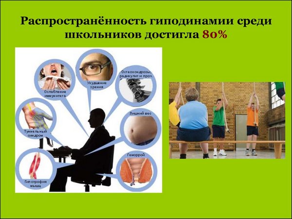гиподинамия 5